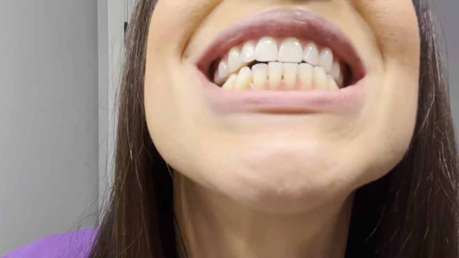 36 Best Fluoridex Sensitivity Relief Toothpaste 2024 Teeth Health